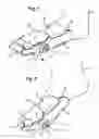 Fig. 02 - Orthosis for correcting the position of a body joint