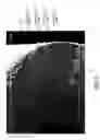 Fig. 03 - Structurally optimized hollow fiber membranes