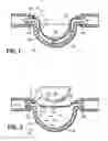 Fig. 02 - Diaphragm-based reservoir for a closed blood sampling system
