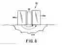 Fig. 07 - High frequency treatment device having a pair of jaws with electrodes