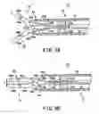 Fig. 08 - High frequency treatment device having a pair of jaws with electrodes