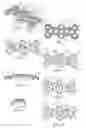 Fig. 02 - Multilock anterior cervical plating system
