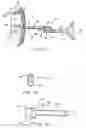Fig. 07 - Multilock anterior cervical plating system