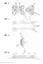 Fig. 02 - Bone fixation device