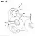 Fig. 11 - Bone fixation device