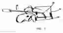 Fig. 02 - Universal percutaneous spinal access system