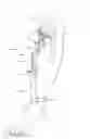 Fig. 01 - Tibial cutting guide having variable adjustment