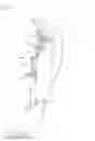 Fig. 02 - Tibial cutting guide having variable adjustment