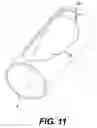 Fig. 09 - Surgical fastener