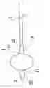 Fig. 06 - Balloon catheter