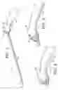 Fig. 02 - Ergonomic handle and articulating laparoscopic tool