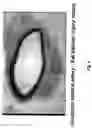 Fig. 09 - Electrical devices and anti-scarring agents