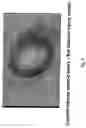 Fig. 10 - Electrical devices and anti-scarring agents