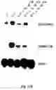 Fig. 15 - Electrical devices and anti-scarring agents