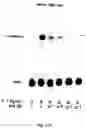 Fig. 19 - Electrical devices and anti-scarring agents
