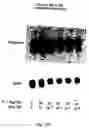 Fig. 20 - Electrical devices and anti-scarring agents