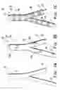Fig. 03 - Cast bioremodelable graft
