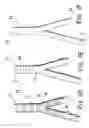Fig. 04 - Cast bioremodelable graft