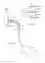 Fig. 09 - Systems and methods for attaching a prosthesis within a body lumen or hollow organ
