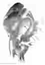 Fig. 09 - Method and apparatus for replacing a mitral valve and an aortic valve with a single homograft