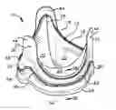 Fig. 01 - Low profile heart valve prosthesis