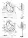 Fig. 02 - Low profile heart valve prosthesis