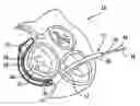 Fig. 01 - Body lumen device anchor, device and assembly