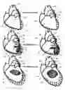 Fig. 02 - Systems for heart treatment