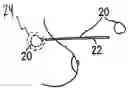 Fig. 01 - Tissue marking implant