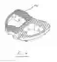 Fig. 06 - Vertebral body replacement apparatus and method