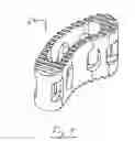 Fig. 07 - Vertebral body replacement apparatus and method