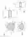 Fig. 02 - Hemi-artificial contoured spinal fusion implants made of a material other than bone