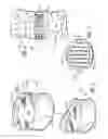 Fig. 03 - Hemi-artificial contoured spinal fusion implants made of a material other than bone