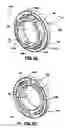Fig. 06 - Modular implant for fusing adjacent bone structure