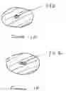 Fig. 04 - Modular artificial disc replacements (ADRS) that allow translocation and axial rotation