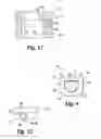 Fig. 04 - Height adjustable vertebral body and disc space replacement devices