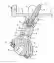 Fig. 01 - Endoprosthesis for part of the pelvis