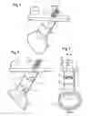 Fig. 02 - Endoprosthesis for part of the pelvis
