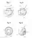 Fig. 06 - Endoprosthesis for part of the pelvis