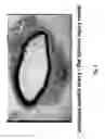 Fig. 09 - Soft tissue implants and anti-scarring agents