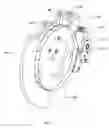 Fig. 17 - Synchronized mechanical continuously variable transmission