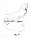 Fig. 07 - Method and apparatus for scrap removal from rotary dies