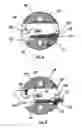 Fig. 09 - Submunition fuze