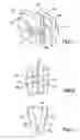 Fig. 04 - Electromagnetic valve actuating device for an internal combustion engine
