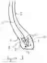 Fig. 02 - Tire with non-linear anchoring of the reinforcement structure