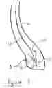 Fig. 04 - Tire with non-linear anchoring of the reinforcement structure