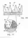 Fig. 09 - Brazed wick for a heat transfer device