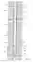 Fig. 11 - Downhole fluid disposal apparatus and methods