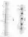 Fig. 02 - Slotted slip element for expandable packer