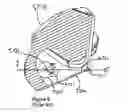 Fig. 07 - Nozzle bore for high flow rates